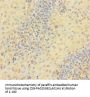 TYMP Antibody