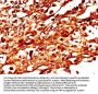 TYR Antibody