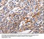 ACE2 Antibody