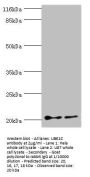 UBE2C Antibody
