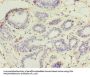 UBE2D1 Antibody