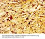 UBE2D2 Antibody