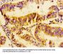 UBE2D2 Antibody