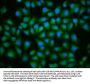 UBE2D2 Antibody