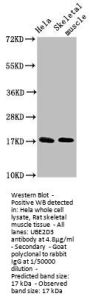 UBE2D3 Antibody