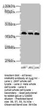HNRNPD Antibody