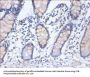 HNRNPD Antibody