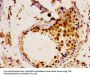 UBE2L3 Antibody