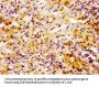 UBE2L3 Antibody
