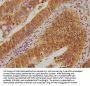 UBE2M Antibody