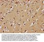 UBE2M Antibody