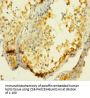 UCK1 Antibody