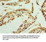 UCP1 Antibody