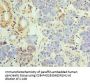 UCP1 Antibody