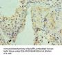 UCP1 Antibody