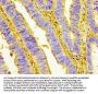 UCP1 Antibody