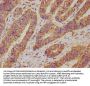 UCP2 Antibody