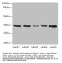 UCP3 Antibody