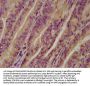 UGT1A6 Antibody