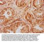 UMODL1 Antibody