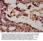 UNC5B Antibody