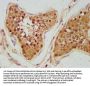 UNC5B Antibody