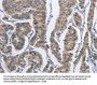 DSG2 Antibody