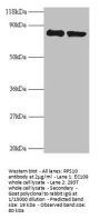 RPS10 Antibody