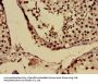 USO1 Antibody