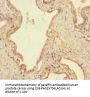 USP14 Antibody