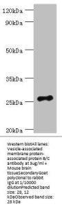 VAPB Antibody