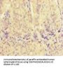 VDAC2 Antibody