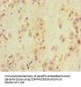 VDAC2 Antibody