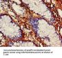 VEGFB Antibody