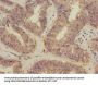 VEGFB Antibody