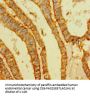 VIM Antibody
