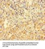 VIM Antibody