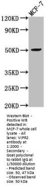 VIPR2 Antibody