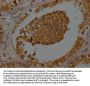 VPS26A Antibody