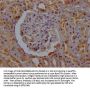 VPS26A Antibody