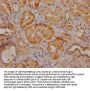 VPS26A Antibody