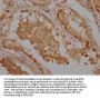 VPS26A Antibody