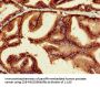 MYC Antibody
