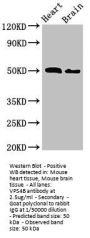 VPS4B Antibody