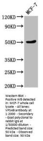 VPS4B Antibody