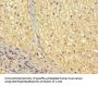 VTN Antibody