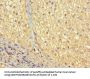 VTN Antibody