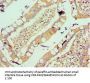 VTN Antibody