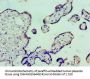 VTN Antibody