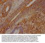 WARS Antibody